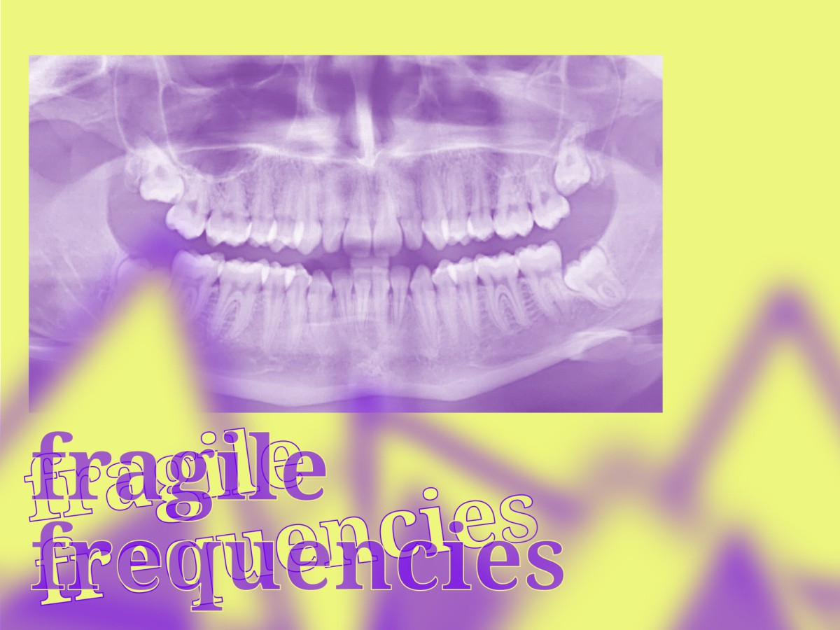 Eine Röntgenaufnahme von einer menschlichen Mundhöhle